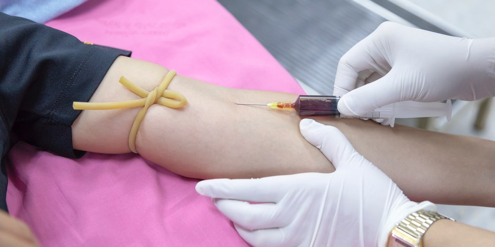 Young Blood Plasma Treatment