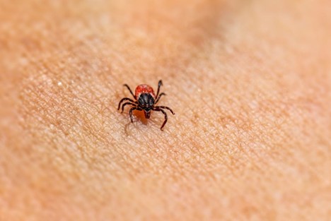 Could a Tick Bite Be the Cause of Your Meat Allergy? All About Alpha-gal Syndrome